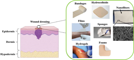 Various types of wound dressings.