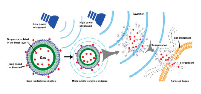 Ultrasound-Responsive Controlled-Release Nanocarriers