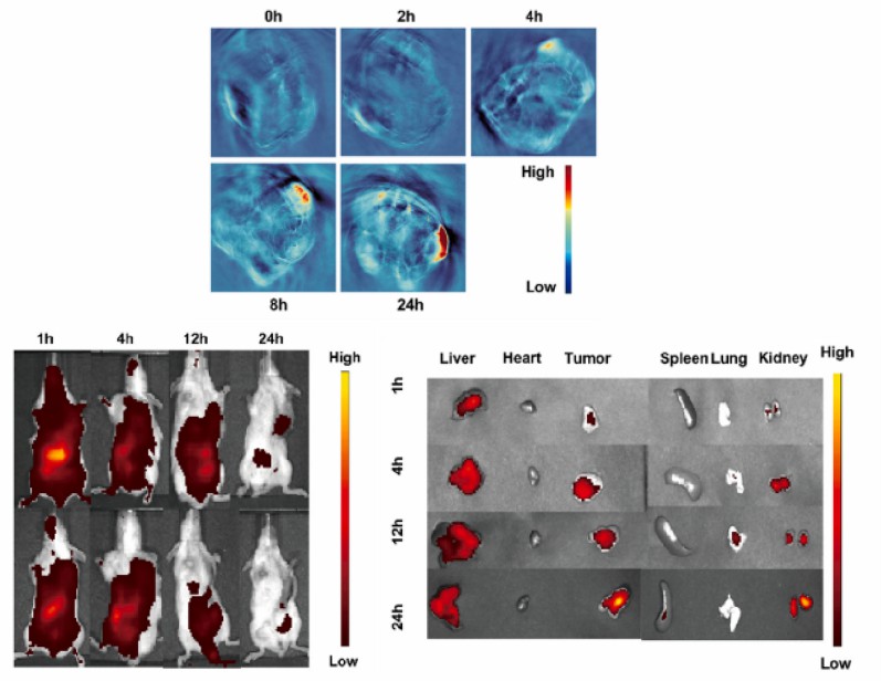 Visualization of imaging maps inside and outside the organism.