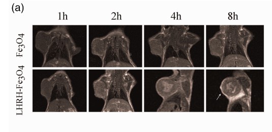 The imaging pictures of Fe3O4 in breast cancer.