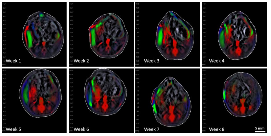 Photoacoustic imaging of gold nanorods in vivo.