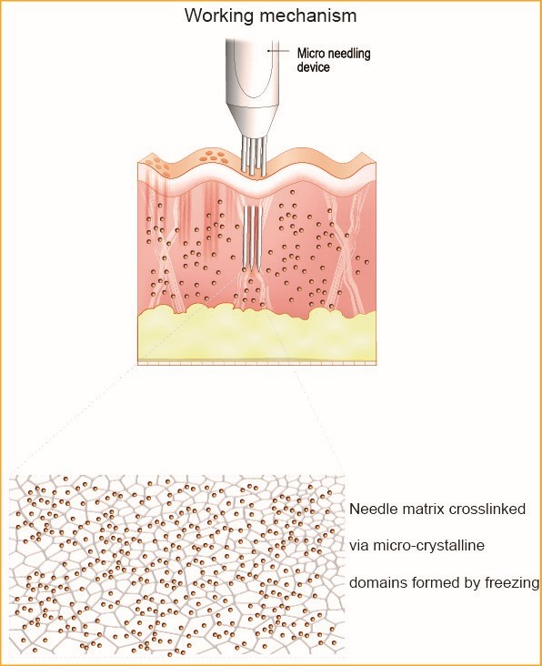 Figure 1. Rapid-Released Microneedle Patches.