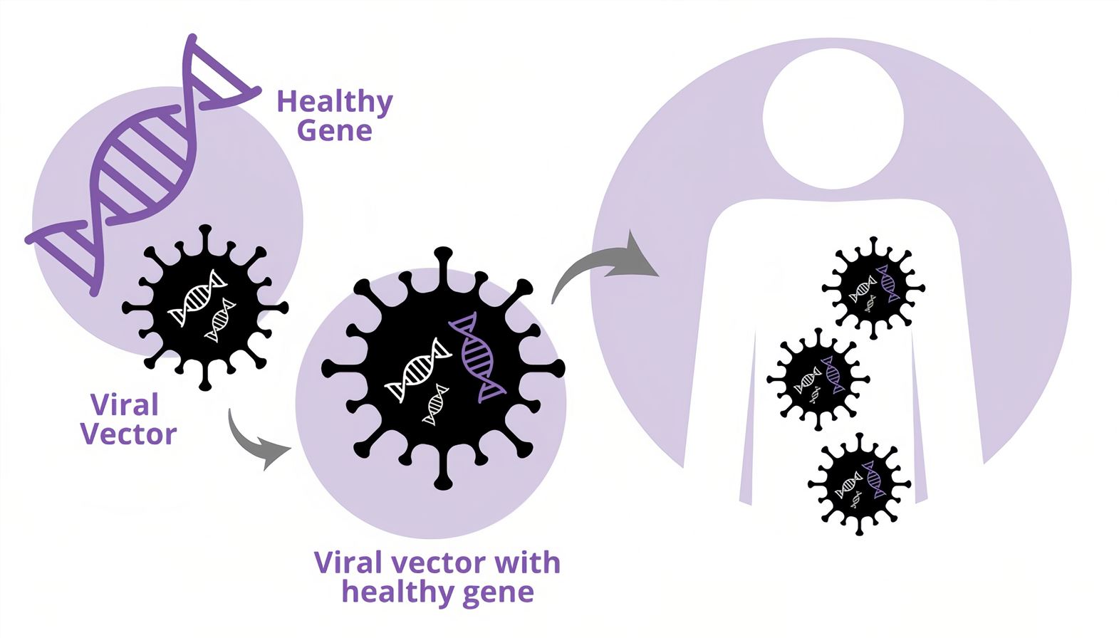 Viral vector-based gene therapy