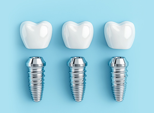 Controlled-Release Implant Drug Delivery System