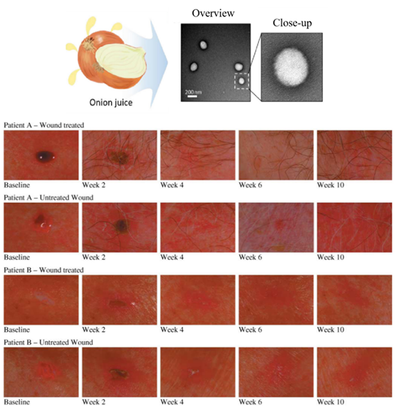 Biomolecules present in exosomes