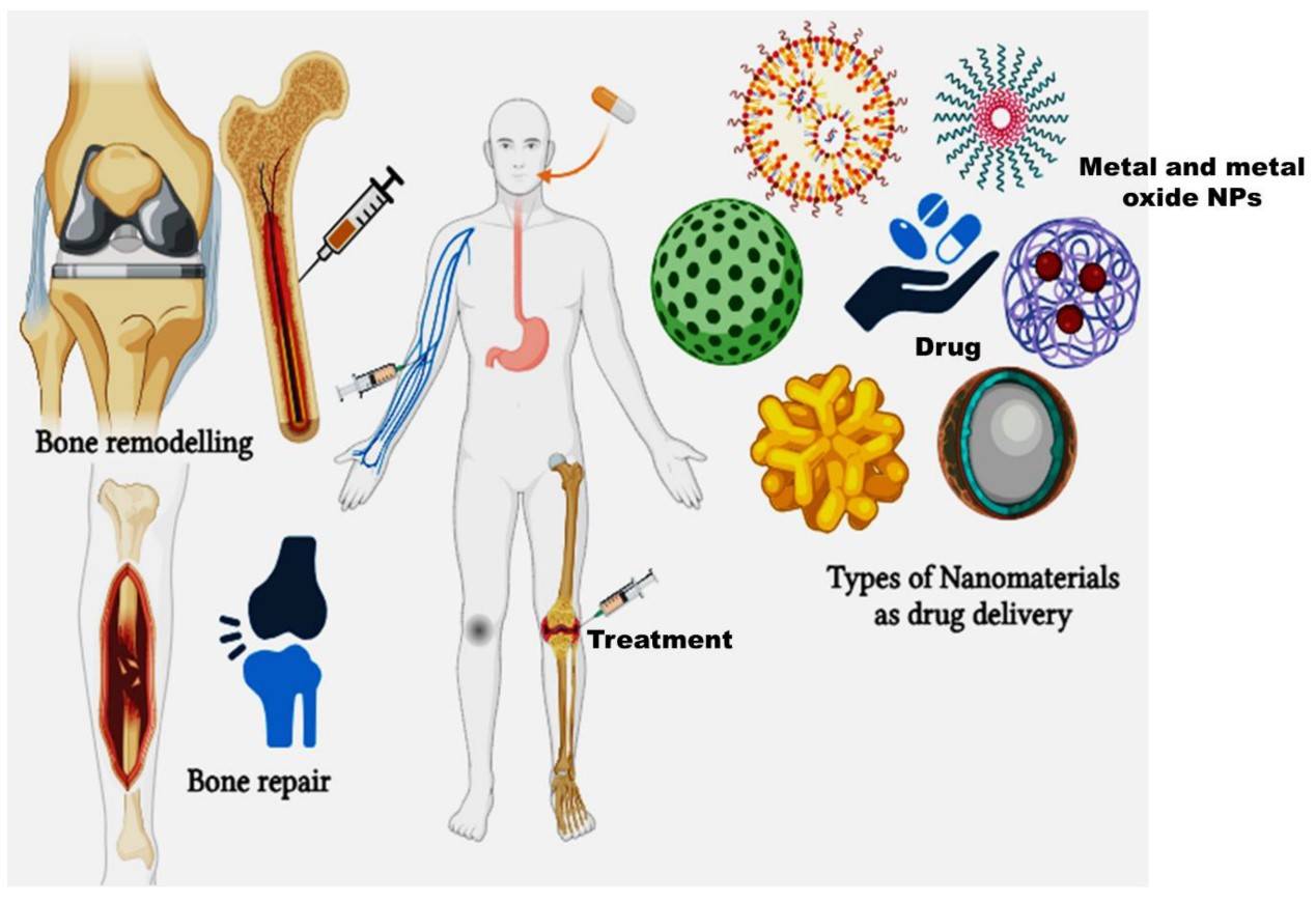 Figure 1. Nanomaterials as Types of Drug Delivery Systems in Bone Repair and Remodeling.