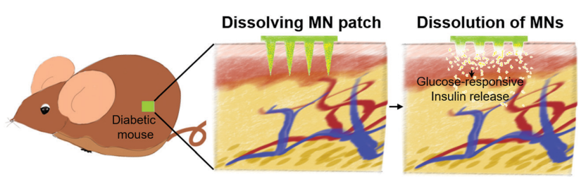 Microneedle patches for drug transportation.